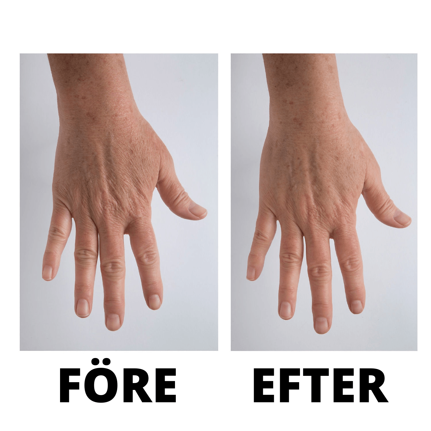 BeautyCare - En handkräm som förnyar dina händer